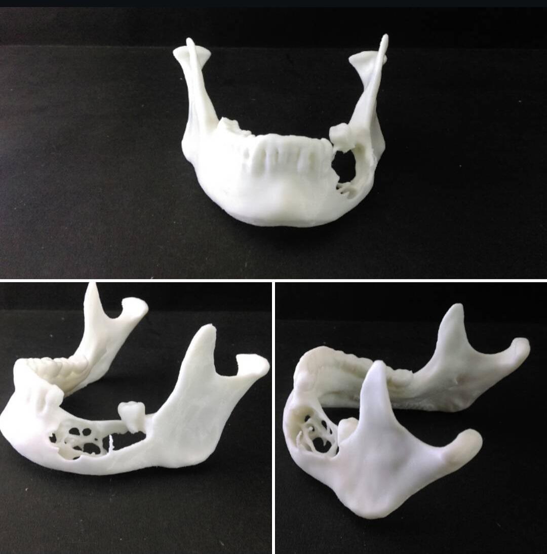 3D printed anatomical model